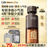 C咖胶态硫净痘温和洁面泡沫140ml控油祛痘清洁氨基酸慕斯洗面奶