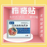 蕴祥火疖子非拔毒膏疖子非拔脓贴疖疮贴毛囊包非拔毒贴硬块坐板穴位贴 15贴送5贴同款共 1贴*20袋