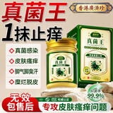 广济珍真菌王香港脚气止痒脱皮烂脚丫真菌感染水起小泡根抑菌软膏非药治