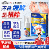 松尾制药日本脚气喷雾剂真菌感染脱皮止脚瘙痒臭烂脚丫汗水泡糜烂特效杀菌