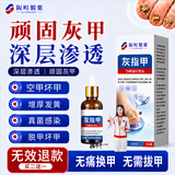 阪町製薬灰指甲真菌感染脱甲坏甲增厚发黄变厚变空特效专用亮甲20ml*1盒