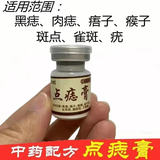胖东来同款点痣膏无痕药水祛痣套装黑点脸部痦子无痛黑痣斑点神器正品店 点痣膏（2瓶）