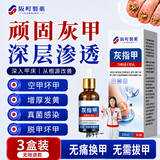 阪町製薬灰指甲真菌感染脱甲坏甲增厚发黄变厚变空特效专用亮甲20ml**3盒