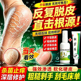 [科田]华佗膏 脚后跟真菌感染干裂脱皮专用药干裂起硬皮真菌药(发货特效)角化型脚气专用药干裂粗糙皲裂 华佗膏1支+盐酸特比萘芬喷雾剂1瓶 【一喷一抹】
