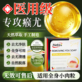 HEBST去疣香皂医用扁平疣专用疣体脱落全身脖子小肉粒祛疣药皂2盒