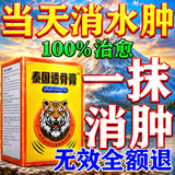 泰国金老虎下肢水肿消肿专用膏药贴利尿剂消水肿专用喷药老年人用脚肿浮肿药 特效膏1盒【水肿当天消】 消肿止疼痛活血化瘀外用