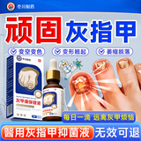 冭川制药灰指甲特有效专用搭药重度指甲增厚发黄变厚变空坏甲真菌感染正品