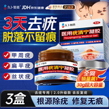 久卜制药扁平疣专用克疣去疣药膏神器丝状疣脖子小肉粒疣体脱落祛疣膏3盒