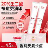 质润壬二酸凝胶20%壬二酸乳膏祛痘印修复淡化痘印非医用祛痘膏30g