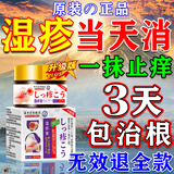 北京协和医学院日本进口湿疹药膏止痒抑菌皮肤瘙痒去顽固湿毒十大牌子干燥去i根 特效1盒【日本进口】一抹止痒 皮炎湿疹皮癣真菌感染荆肤软膏