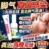 [华青]克霉唑乳膏 脚气止痒脱皮烂脚丫真菌感染根药治(发货特效)脚气药除脚气脚臭脚痒脚烂药官方正品 克霉唑乳膏1盒+盐酸特比萘芬喷雾剂1瓶 【双效治】