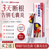 久卜制药毛囊炎药膏止痒专用特效脂溢性皮炎前胸后背头皮脓包马拉色菌3盒
