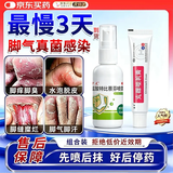 [华青]克霉唑乳膏 10g 1盒+[伊人]盐酸特比萘芬喷雾剂 15ml:0.15g 1瓶  效  【双效治