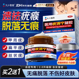 久卜制药扁平疣专用克疣去疣药膏神器丝状疣脖子小肉粒疣体脱落祛疣膏 1盒