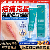 澳愈（ORYURE）祛疤膏去疤痕修复儿童医用硅酮疤痕凝胶专用剖腹产手术缝针除疤