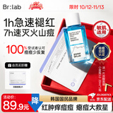蓓安亲研祛痘小蓝瓶3.0点涂精华液20ml 水杨酸青春痘印去闭口粉刺