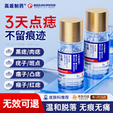 高坂制药点痣膏点斑祛疣药水脸部去黑痣扁平跖疣修复液无痕不留疤非药5ml