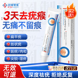 涩冈制薬疣体脱落膏扁疣丝疣尖锐湿疣跖疣脖子小肉粒1盒