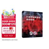 心血管疑难重症病例精析：益心论道中国科学技术出版社韩雅玲周玉杰张抒扬史冬梅柴剑医学从业者疑难重症精析