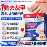 奈立制药灰指甲专用特效贴重度脱甲指甲增厚发黄变厚真菌感染抑菌甲沟