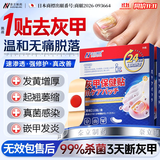 奈立制药灰指甲专用特效贴重度脱甲指甲增厚发黄变厚真菌感染抑菌甲沟