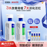 EHD水杨酸祛痘沐浴露500ml*2控油祛痘清洁保湿舒缓芳香3天祛背痘