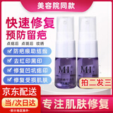 点痣疤痕修复液去凹陷红印去痘印点斑冰晶美容院激光点痣后修复膏 点痣疤痕修复液【美容院同款】 一瓶装【拍2发3】