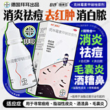 拜耳 克林霉素甲硝唑搽剂40ml双效祛痘去红肿消白脓痘痘杀菌抑菌消炎酒渣鼻毛囊炎痤疮溢脂性皮炎痤康王 5盒【药房直发】毛囊炎酒糟鼻