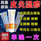 [舒夫林]曲安奈德益康唑乳膏 25g 2盒装 大腿根内测潮湿瘙痒股癣真菌感染腹股沟股癣私处股藓专用药膏皮肤用药非处方 男士私处真菌感染潮湿瘙痒