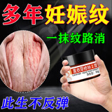 乐修妊娠纹修复产后去除100%消除紧致肚皮淡化生长肥胖纹预防修复霜 买2送1【一抹当天消】