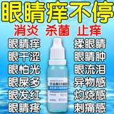 眼睛痒病毒性结膜炎眼痒眼药水止痒眼角发痒红肿疼痛眼酸眼胀模糊过敏性 红血丝 异物感珍珠明目滴眼液 1盒