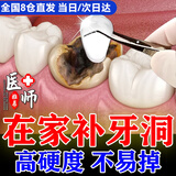 补牙洞材料 自己补牙树脂医用级纳米补牙洞缺牙牙缝宽大填充神器 15毫升（可补8-15颗）