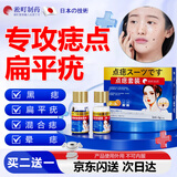 淞町制药点痣膏脸部祛除黑痣去斑点扁平丝状跖疣水不留疤痕修复液专用非药