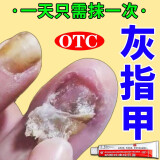 硝酸咪康唑乳膏灰指甲专用药指甲真菌感染脱甲坏甲药灰指甲特新效药根据说明治正品药第1次购买名额发货特快 1盒【治疗灰指甲的专用药】