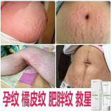 粉嫩公主孕期妊娠霜孕纹护理产后纹路专用孕妇妊娠油紧致膏 孕纹修护霜一瓶