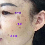比芭美（PIBAMY）美白祛斑霜 黄褐斑雀斑 老年斑烟酰胺提亮淡化黑色素去黄改善肤色 一瓶装