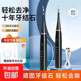 多功能超频声波洁牙器牙刷替换便携洗牙器牙结石去除神器大功率清理黑斑烟渍黄垢高频磨牙齿工具 【洁牙器+1口腔镜】黑色（含洁牙头）