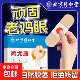 北京同仁堂鸡眼贴鸡眼膏鸡贴眼膏鸡茧膏去除老茧脚底手上肉刺瘊子 轻微鸡眼【1盒装】共6贴