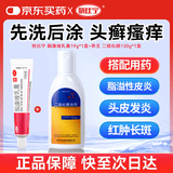 快比宁 酮康唑乳膏19g+希王 二硫化硒洗剂130g 治真菌感染毛囊炎脂溢性皮炎头皮癣发炎瘙痒红肿脓包长斑
