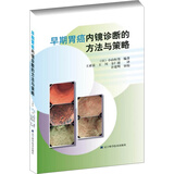早期胃癌内镜诊断的方法与策略