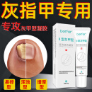 berfer 灰指甲皮肤癣菌增厚发黄脚趾甲真菌感染医用退热凝胶II型 20g