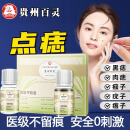 人仁和匠心点痣药l水去痣药l水无痕脸部面部祛痣药l水痦子点痣膏5g+5ml