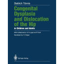 预订Congenital Dysplasia and Dislocation of the Hip