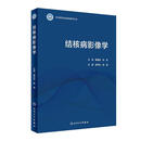 结核病影像学 侯代伦,柳澄 人民卫生出版社 9787117284547