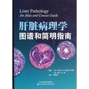 【正版微瑕】肝脏病理学图谱和简明指南 (美)苏瑞尔韦内塔,(美)桑　编著,章明放　等译