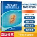 正版 电子胎心监护规范解读及实例分析 广东科技出版社
