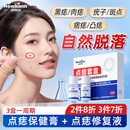 纽利安（Newliann）点痣膏去痣修复液脸部点疣药水祛斑疤痕无痕美容院专用官方正品