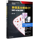 肺部高分辨率CT(第2版)(精)