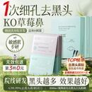 维特丝去黑头鼻贴10组20片免撕拉面膜导出液收缩毛孔清洁粉刺神器男女士