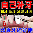 补牙3m美国进口树脂自己在家填充剂材料永久医用堵牙洞缝宽大神器 一包装【能补10颗牙】